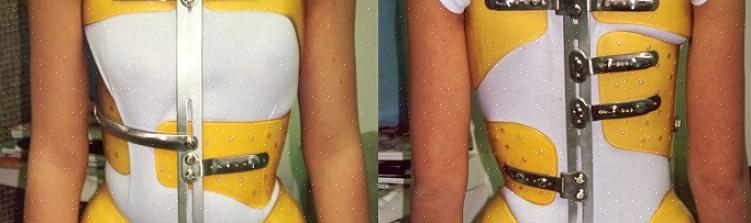 חיזוק הבטן מורכב מכיווץ שרירי הבטן ורצפת האגן