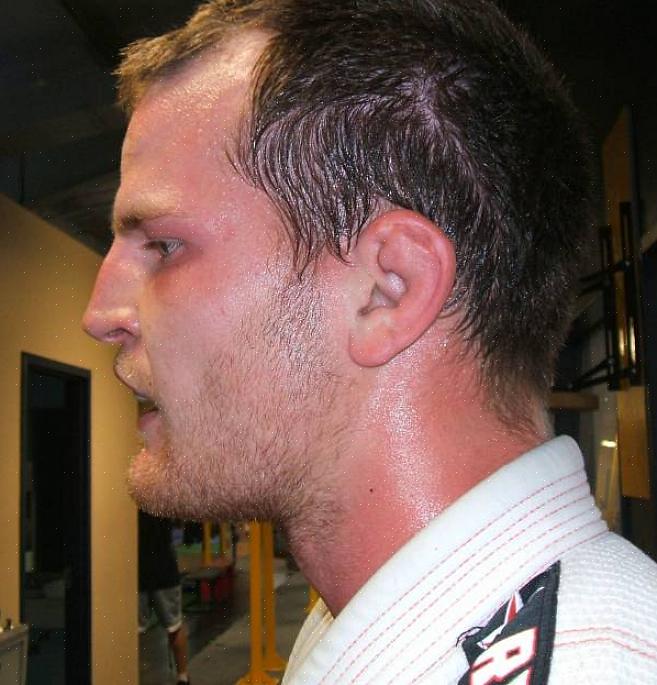 הסיבה הבסיסית להיווצרות אוזני כרובית היא טראומה לאוזן