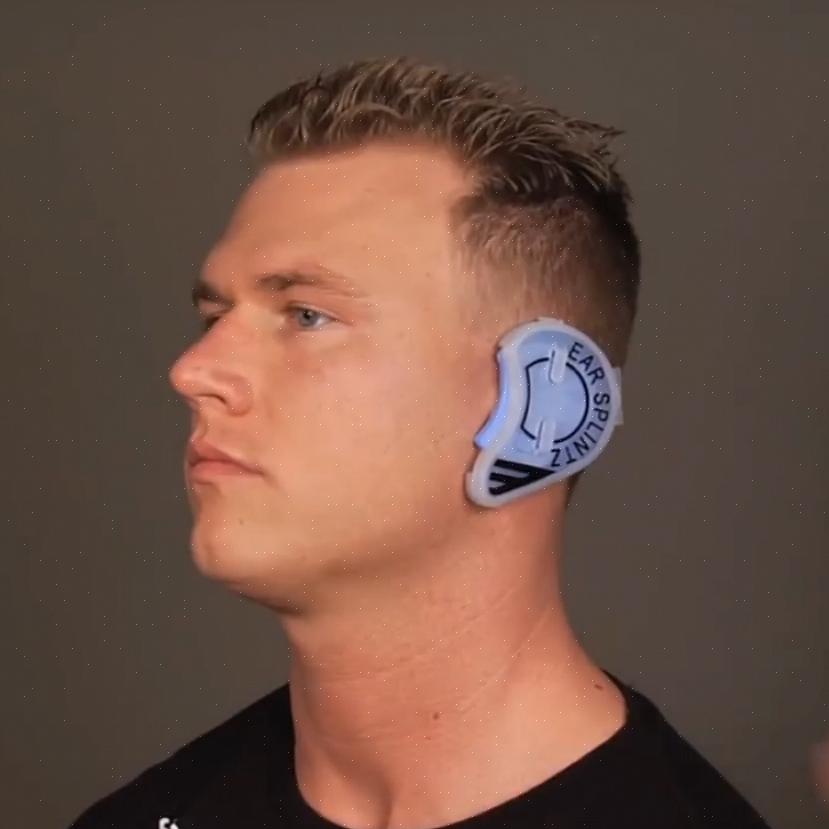 השם הטכני לאוזן כרובית הוא המטומה אוריקולרית