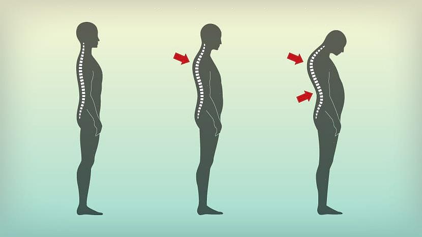 אחת הדרכים הנפוצות ביותר היא באמצעות יציבה לקויה