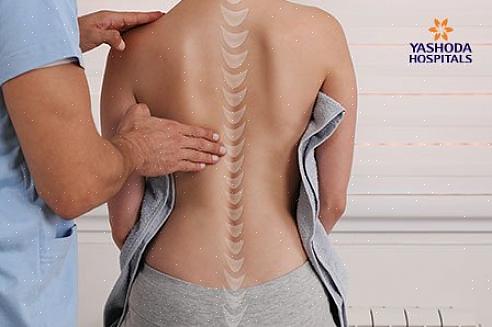 איך לטפל בו וכיצד לשפר את היציבה